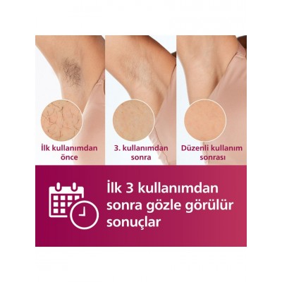 Philips Lumea BRI950/00 Lumea Lazer Epilasyon IPL Tüy Alma Cihazı Yüz+Vücut+Hassas Bölge Kullanımı,Kablolu/Kablosuz Kullanım
